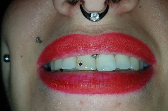 Kit de brillantes para dientes